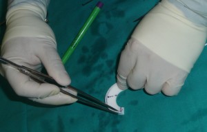 Preparación menisco interno artificial